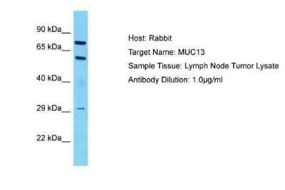 Western Blot: MUC13 Antibody [NBP2-85336]