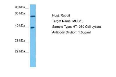 Western Blot: MUC13 Antibody [NBP2-85336]