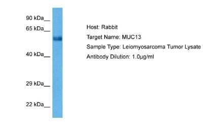 Western Blot: MUC13 Antibody [NBP2-85337]