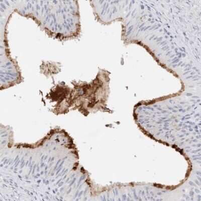 Immunohistochemistry-Paraffin: MUC15 Antibody [NBP1-86406]