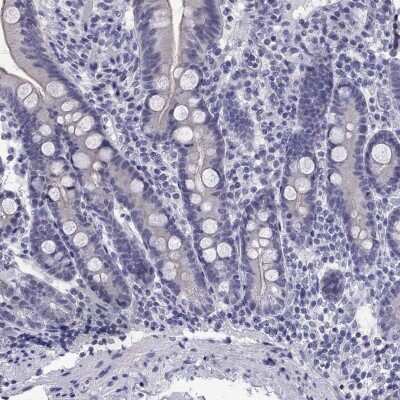 Immunohistochemistry-Paraffin: MUC15 Antibody [NBP3-17128]