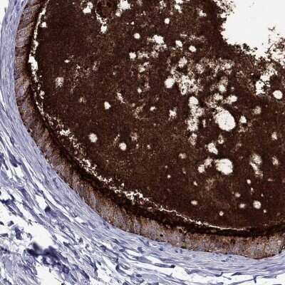 Immunohistochemistry-Paraffin: MUC15 Antibody [NBP3-17128]