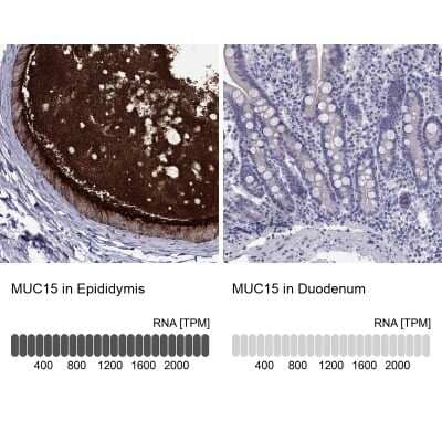 Immunohistochemistry-Paraffin: MUC15 Antibody [NBP3-17128]