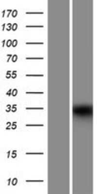 Western Blot: MUC15 Overexpression Lysate [NBP2-09564]