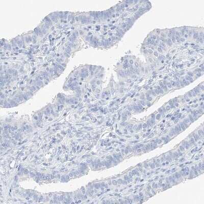 Immunohistochemistry-Paraffin: MUC17 Antibody [NBP1-91013]