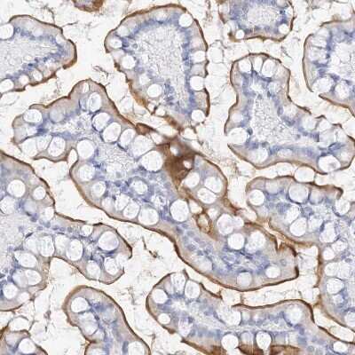 Immunohistochemistry-Paraffin: MUC17 Antibody [NBP1-91013]