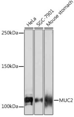 Western Blot: MUC2 Antibody (4L5Y8) [NBP3-16481]