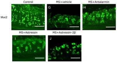 Immunohistochemistry: MUC2 Antibody (996/1) - BSA Free [NB120-11197]