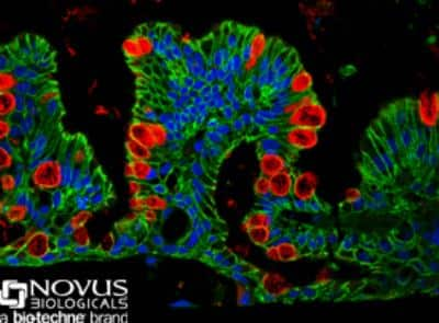 Immunohistochemistry: MUC2 Antibody [NBP1-31231]