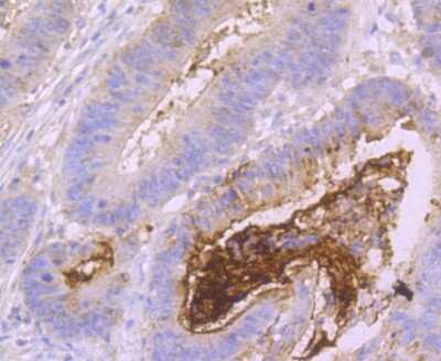 Immunohistochemistry-Paraffin: MUC2 Antibody (JA10-92) [NBP2-66961]