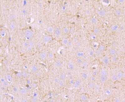 Immunohistochemistry-Paraffin: MUC2 Antibody (JA10-92) [NBP2-66961]