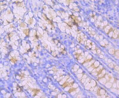 Immunohistochemistry-Paraffin: MUC2 Antibody (JA10-92) [NBP2-66961]
