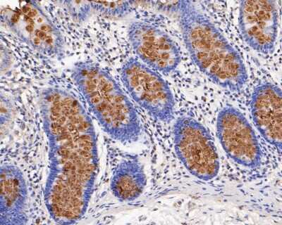 Immunohistochemistry-Paraffin: MUC2 Antibody (JA10-92) [NBP2-66961]