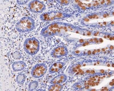 Immunohistochemistry-Paraffin: MUC2 Antibody (JA10-92) [NBP2-66961]