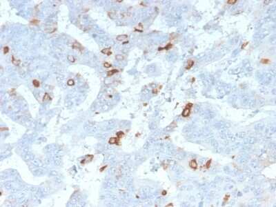 Immunohistochemistry-Paraffin: MUC2 Antibody (MLP/2970R) - Azide and BSA Free [NBP3-08240]