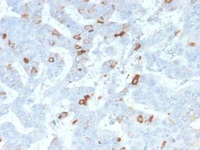 Immunohistochemistry-Paraffin: MUC2 Antibody (MLP/2970R) [NBP3-07238]