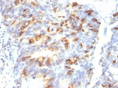 Immunohistochemistry-Paraffin: MUC2 Antibody (MLP/842) [NBP2-44431]