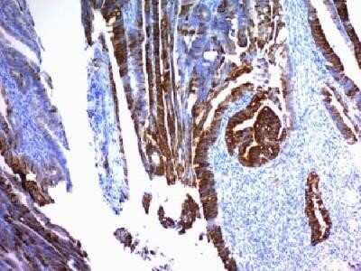 Immunohistochemistry-Paraffin: MUC2 Antibody (SPM296) - Azide and BSA Free [NBP2-34757]