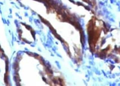 Immunohistochemistry-Paraffin: MUC2 Antibody (SPM296) [NBP2-32984]