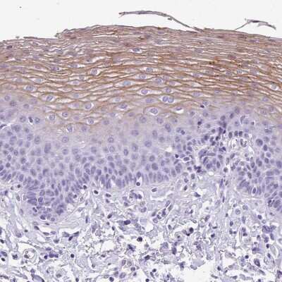 Immunohistochemistry-Paraffin: MUC21 Antibody [NBP2-31023]