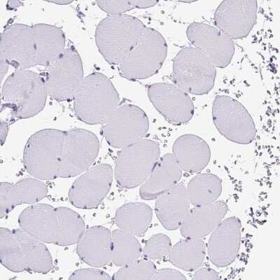Immunohistochemistry-Paraffin: MUC21 Antibody [NBP2-31023]