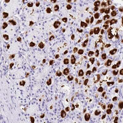 Immunohistochemistry-Paraffin: MUC21 Antibody [NBP2-31023]