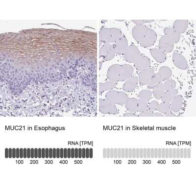 Immunohistochemistry-Paraffin: MUC21 Antibody [NBP2-31023]