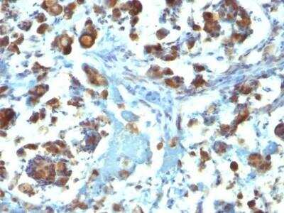 Immunohistochemistry-Paraffin: MUC3 Antibody (M3.1) - Azide and BSA Free [NBP2-47686]