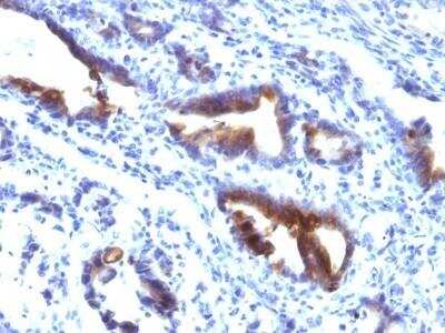 Immunohistochemistry-Paraffin: MUC3 Antibody (M3.1) - Azide and BSA Free [NBP2-47686]