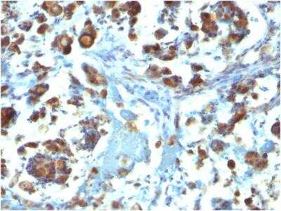 Immunohistochemistry-Paraffin: MUC3 Antibody (M3.1) - IHC-Prediluted [NBP2-48392]