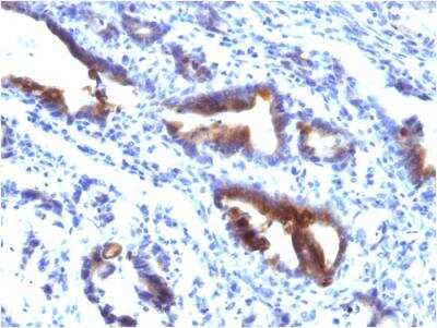 Immunohistochemistry-Paraffin: MUC3 Antibody (M3.1) - IHC-Prediluted [NBP2-48392]