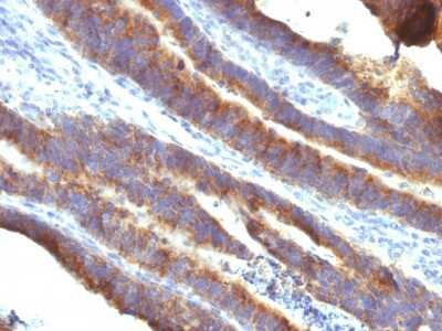 Immunohistochemistry-Paraffin: MUC3 Antibody (M3.1) [NBP2-44432]