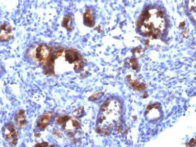 Immunohistochemistry-Paraffin: MUC3 Antibody (MUC3/1154) - IHC-Prediluted [NBP2-48415]