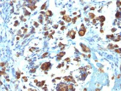 Immunohistochemistry-Paraffin: MUC3 Antibody (MUC3/1154) - IHC-Prediluted [NBP2-48415]