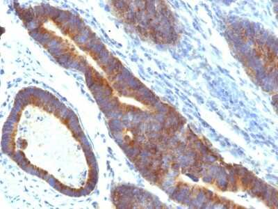 Immunohistochemistry-Paraffin: MUC3 Antibody (MUC3/1154) [NBP2-44434]