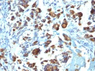 Immunohistochemistry-Paraffin: MUC3 Antibody (MUC3/1154) [NBP2-44434]