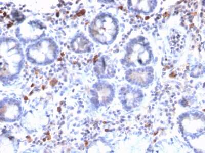 Immunohistochemistry-Paraffin: MUC3 Antibody (MUC3/2992R) - Azide and BSA Free [NBP3-08351]