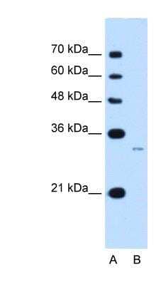 Western Blot: MUC3B Antibody [NBP1-70644]