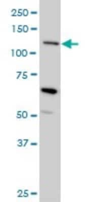 Western Blot: MUC4 Antibody (5B12) [H00004585-M07]