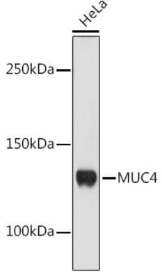 Western Blot: MUC4 Antibody (5J3R7) [NBP3-16186]