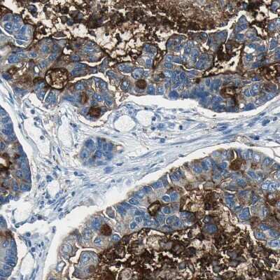 Immunohistochemistry-Paraffin: MUC4 Antibody [NBP1-86505]