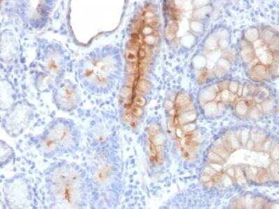Immunohistochemistry-Paraffin: MUC4 Antibody (MUC4/3084) - Azide and BSA Free [NBP2-79866]