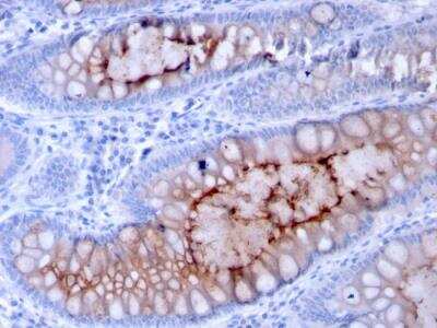 Immunohistochemistry-Paraffin: MUC4 Antibody (MUC4/3084) - Azide and BSA Free [NBP2-79866]