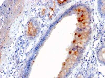 Immunohistochemistry-Paraffin: MUC4 Antibody (MUC4/3084) - Azide and BSA Free [NBP2-79866]