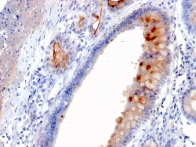 Immunohistochemistry-Paraffin: MUC4 Antibody (MUC4/3084) [NBP2-79731]