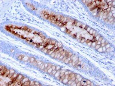 Immunohistochemistry-Paraffin: MUC4 Antibody (MUC4/3105) - Azide and BSA Free [NBP2-79867]