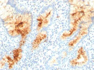 Immunohistochemistry-Paraffin: MUC4 Antibody (MUC4/3105) - Azide and BSA Free [NBP2-79867]