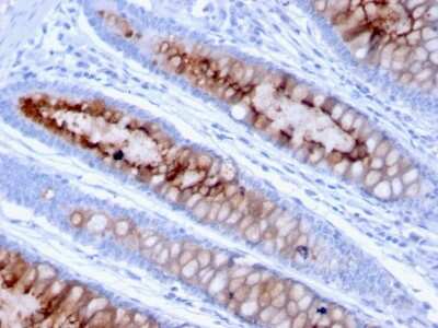 Immunohistochemistry-Paraffin: MUC4 Antibody (MUC4/3105) [NBP2-79732]