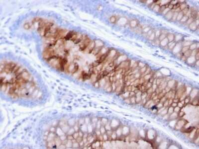 Immunohistochemistry-Paraffin: MUC4 Antibody (MUC4/3105) [NBP2-79732]