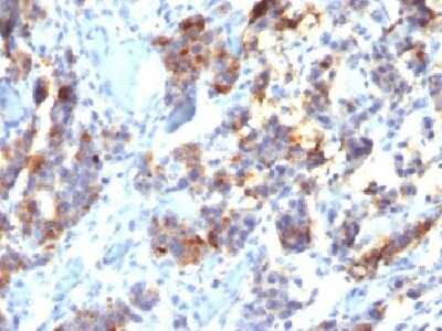 Immunohistochemistry-Paraffin: MUC5AC Antibody (45M1) - Azide and BSA Free [NBP2-32732]